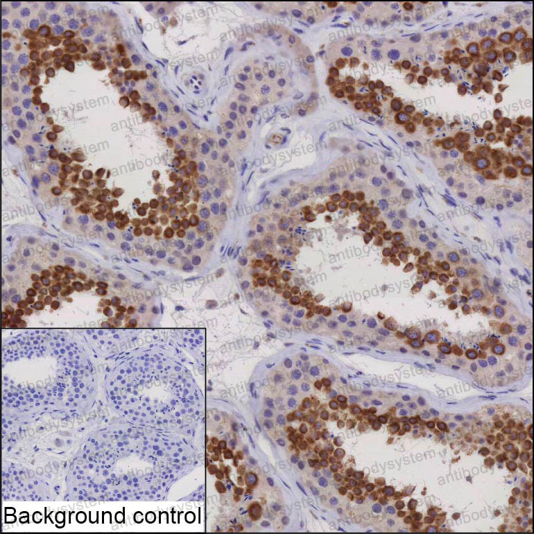 Anti-HEATR4 Antibody (R4D54)