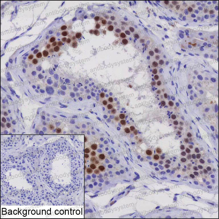 Anti-C3orf62 Antibody (R4D55)
