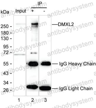 Anti-DMXL2 Antibody (R4D59)