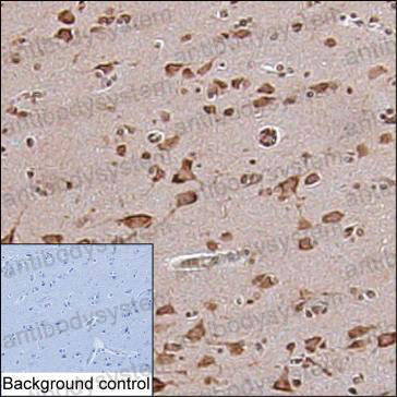 Anti-DMXL2 Antibody (R4D60)