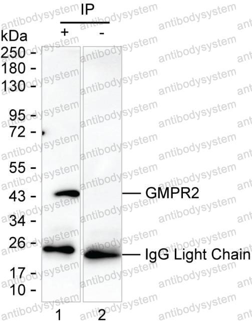 Anti-GMPR2 Antibody (R4D61)