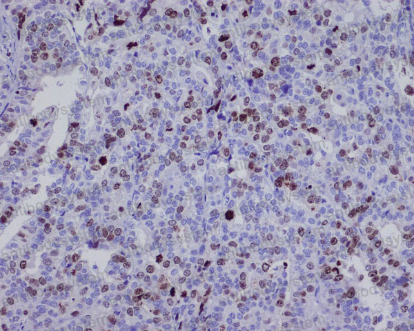 Anti-BIRC5/Survivin Antibody (R1C18)