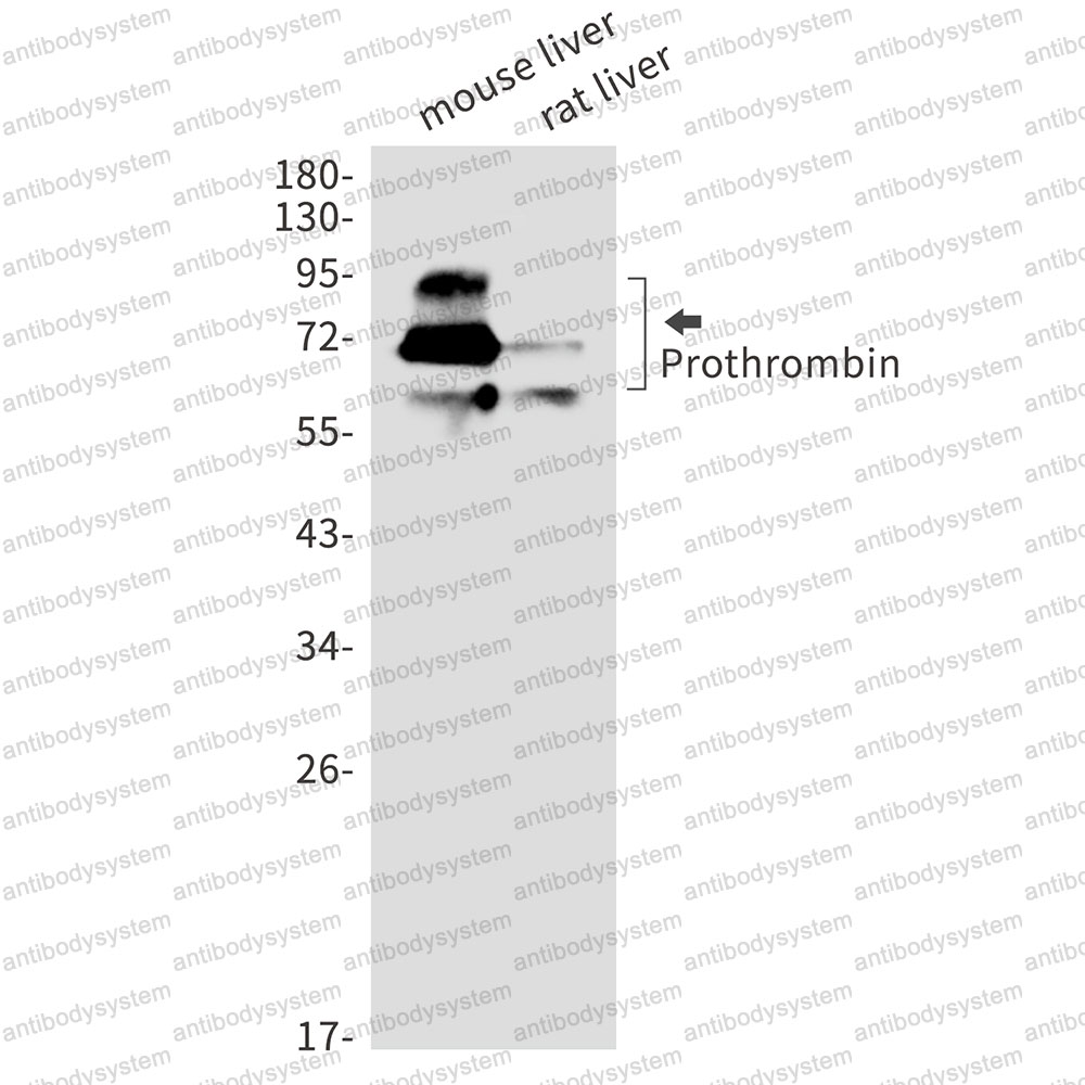 Anti-F2/Prothrombin Antibody (R1H36)