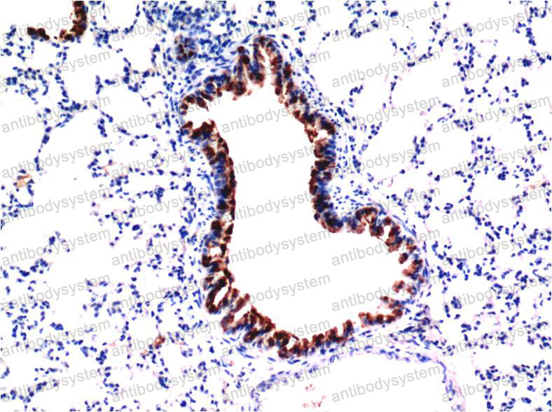 Anti-TGFB1/TGF-beta-1 Antibody (R2X20)