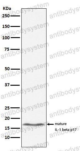 Anti-IL1B/IL1F2 Antibody (R1A44)