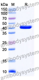 Anti-Mouse CD5/Ly-1 Antibody (SAA2084)