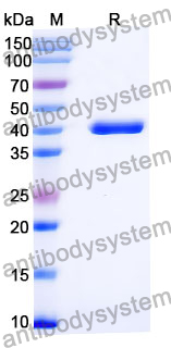 Anti-Mouse CD5/Ly-1 Antibody (SAA2085)