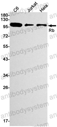 Anti-RB1 Antibody (R1K61)