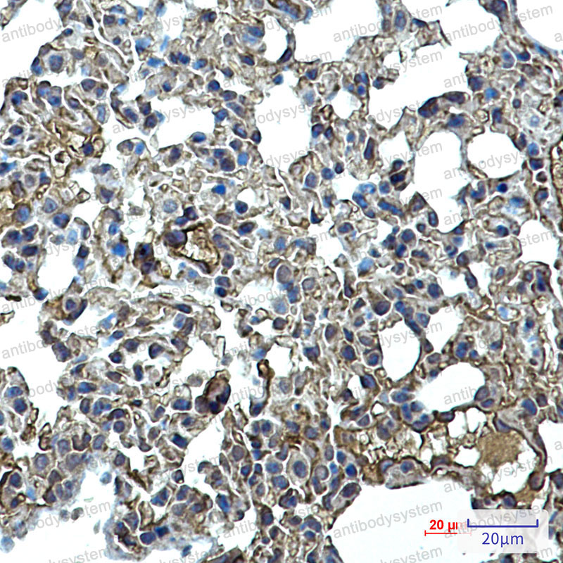 Anti-CD102/ICAM2 Antibody (R1N92)