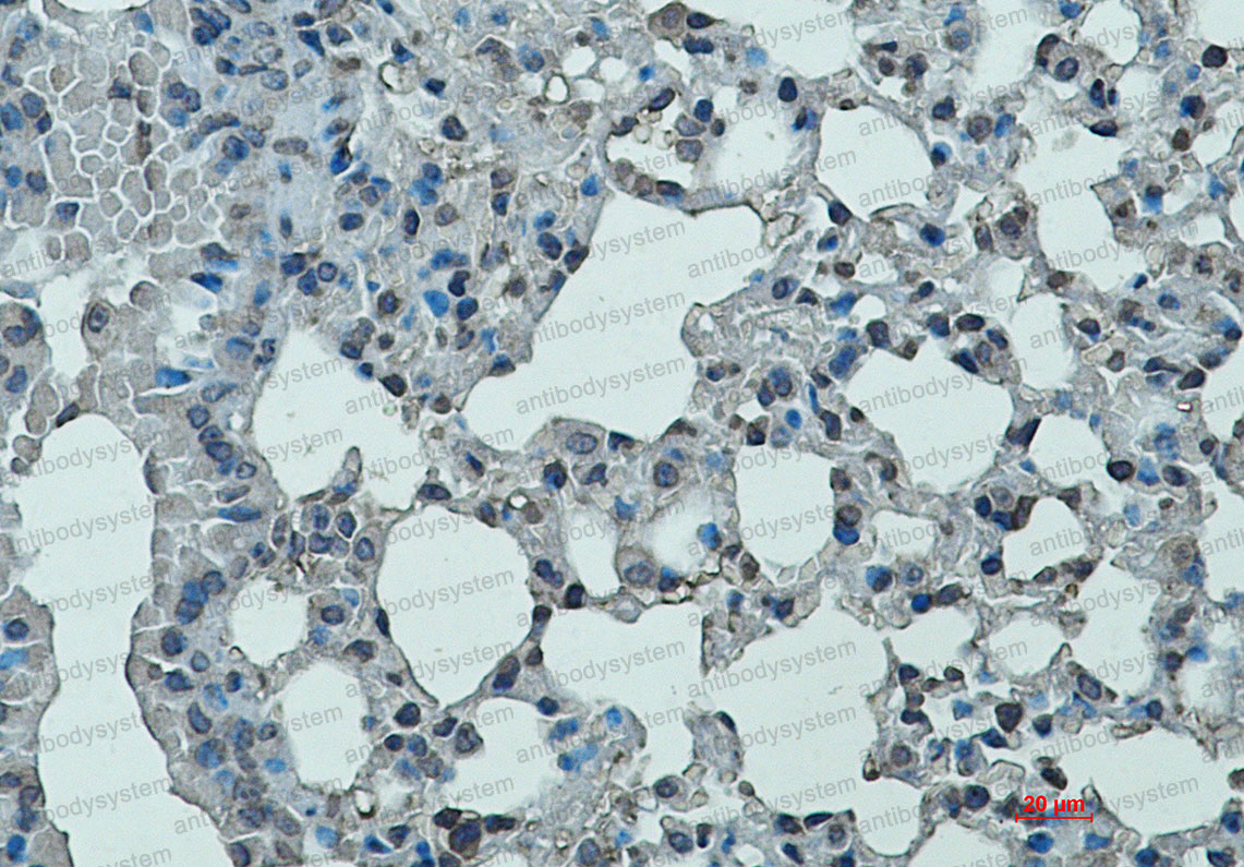 Anti-CD11a/ITGAL Antibody (R1R62)