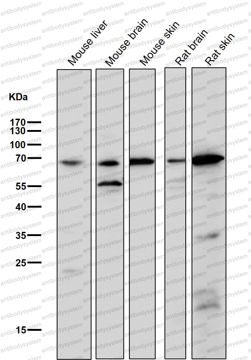 Anti-CHAT Antibody (R1T48)