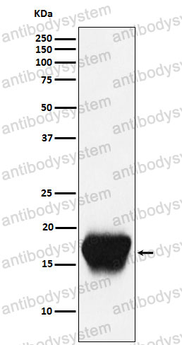 Anti-CD52 Antibody (R1U22)
