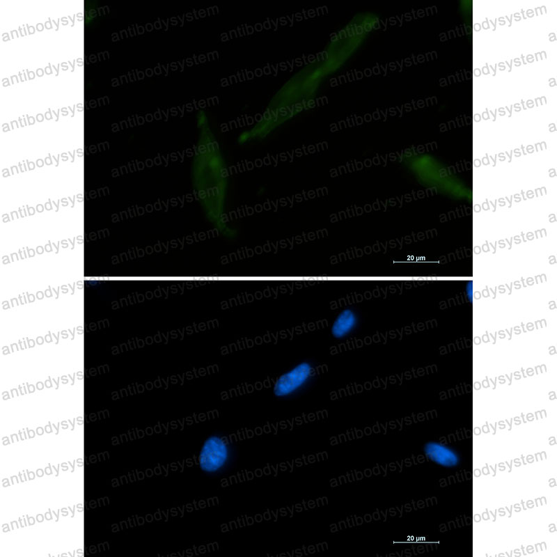 Anti-CD147/BSG Antibody (R1V19)