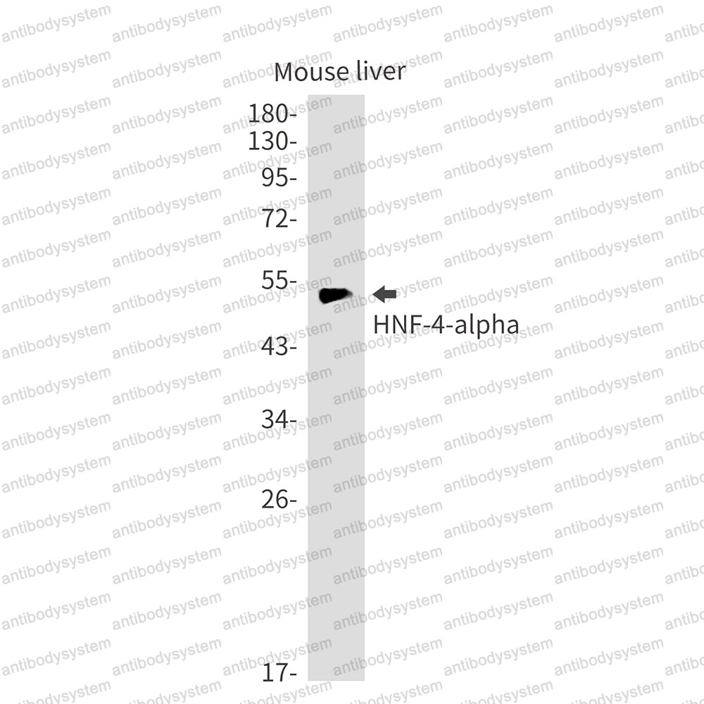Anti-HNF4A Antibody (R1V91)
