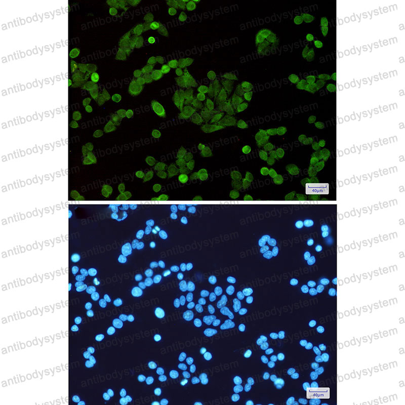 Anti-STAT5A Antibody (R1W06)