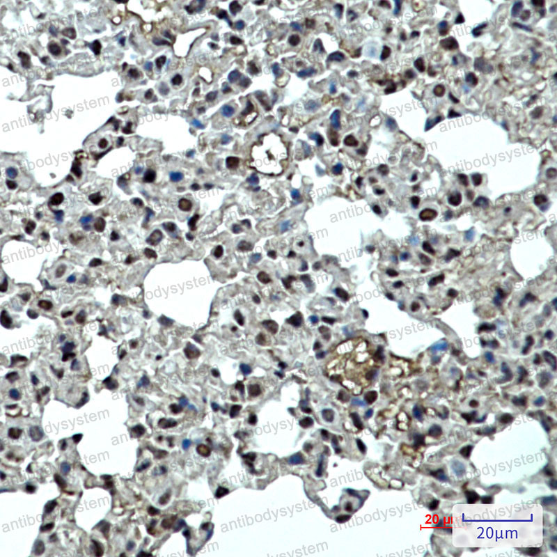 Anti-CDKN1B Antibody (R1W79)