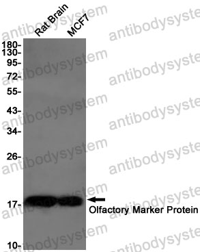 Anti-OMP Antibody (R1W98)