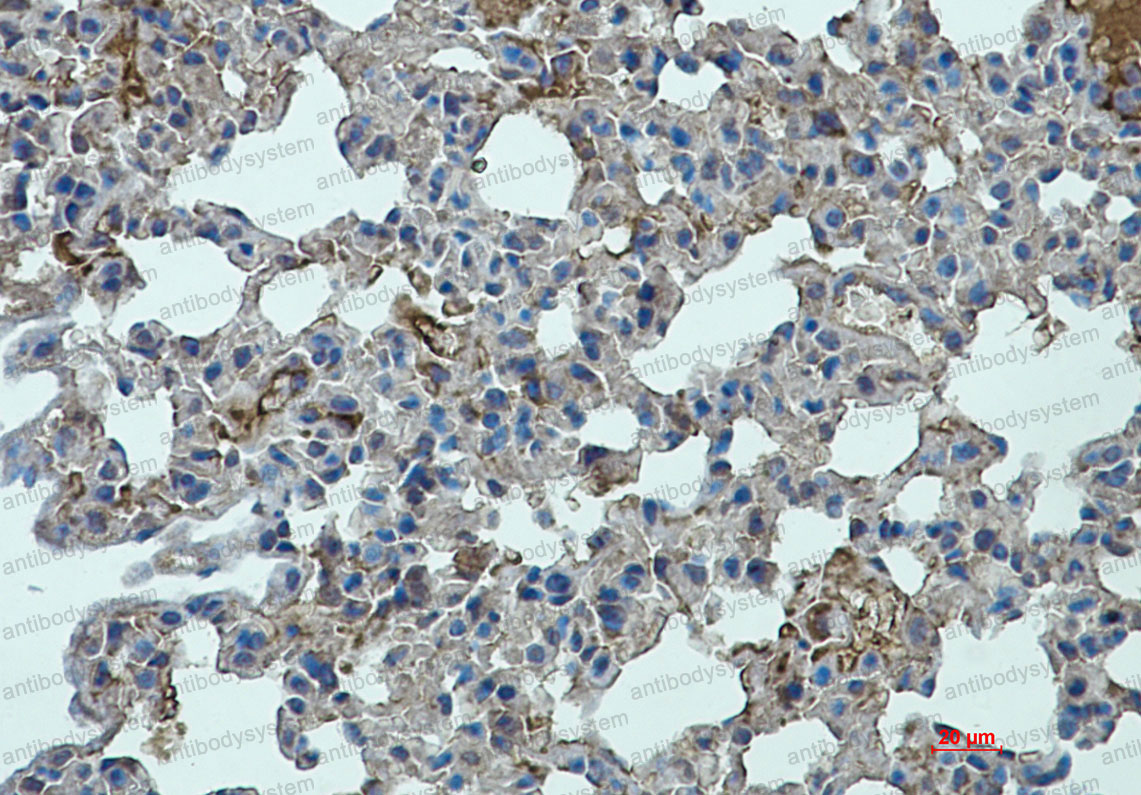 Anti-STAT2 Antibody (R1Y60)