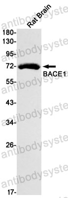 Anti-BACE1 Antibody (R1Z53)