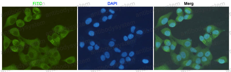 Anti-S100A10 Antibody (R3N84)