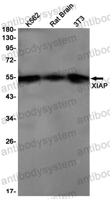 Anti-XIAP Antibody (R2B55)