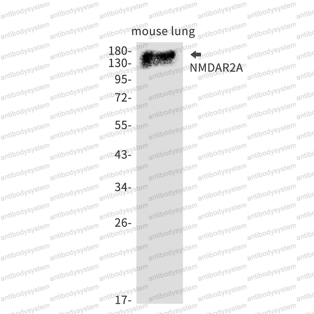 Anti-GluN2A Antibody (R2D48)