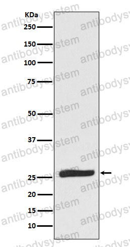 Anti-FADD Antibody (R2D95)