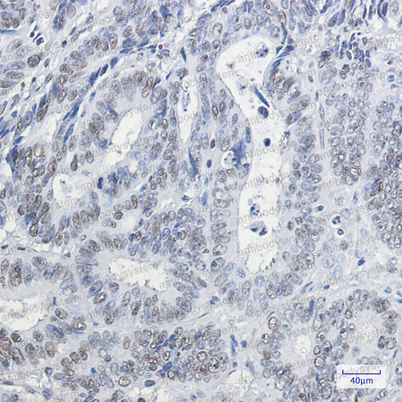 Anti-CBX3 Antibody (R2E03)