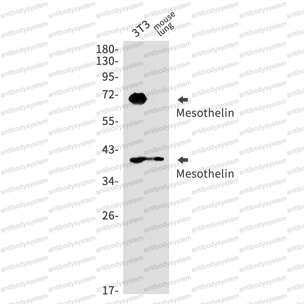 Anti-MSLN/Mesothelin Antibody (R2E30)