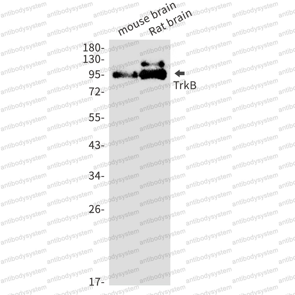 Anti-TrkB /NTRK2 Antibody (R2H22)