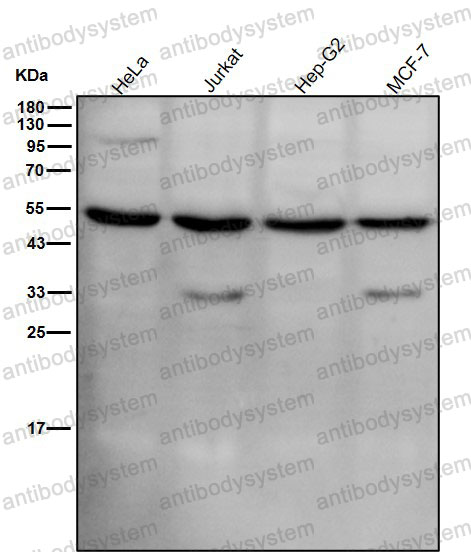 Anti-Phospho-MLKL (S345) Antibody (R1A65)
