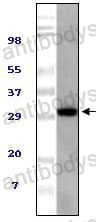 Anti-ASPSCR1/TUG Antibody (R4A32)