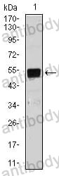Anti-BPIFB1 Antibody (R4A98)