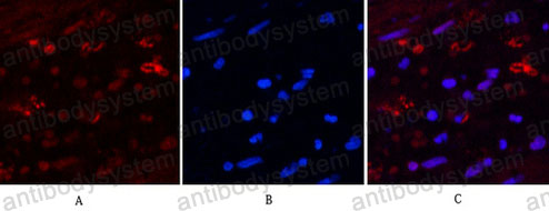 Anti-HAO1 Antibody (R4D69)