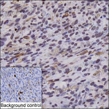 Anti-phospho-MITF (pS157) Antibody (R2V50)