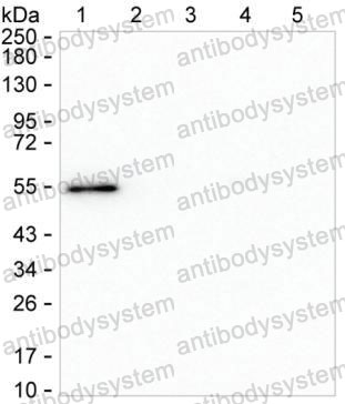 Anti-Rat IgG2a Antibody (R2X67)