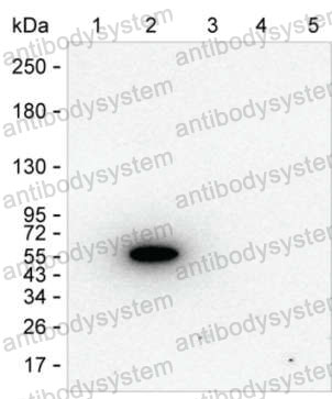 Anti-Rat IgG2b Antibody (R2X69)