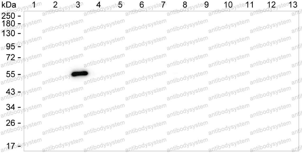 Anti-Rat IgG2b Antibody (R2X70), HRP