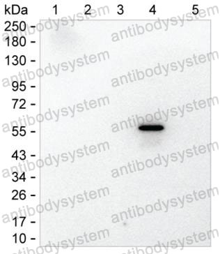 Anti-Rat IgG2c Antibody (R2X71)