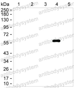 Anti-Rat IgG2c Antibody (R2X72), HRP