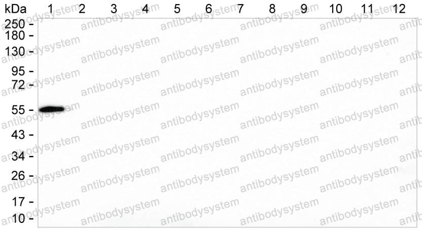 Anti-Rat IgG1 Antibody (R3X94)