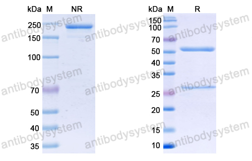 Anti-SARS-CoV-2 S Protein antibody (1H2)