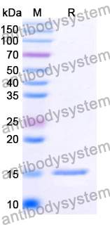 Anti-SARS-CoV-2 S Protein Nanobody (SAA0871)