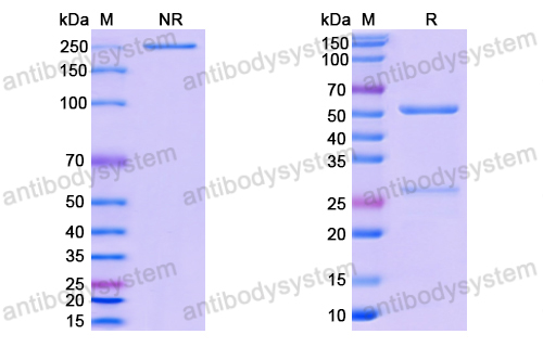 Anti-SARS-CoV-2 RBD antibody (2G1)