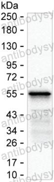Anti-SARS-CoV-2 NP/Nucleoprotein Antibody (R4D70)