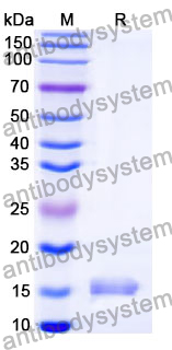 Anti-HRSV F/Fusion glycoprotein F0 Nanobody (SAA1037)