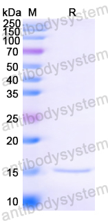 Anti-HIV1 Surface protein gp120 Nanobody (SAA0884)