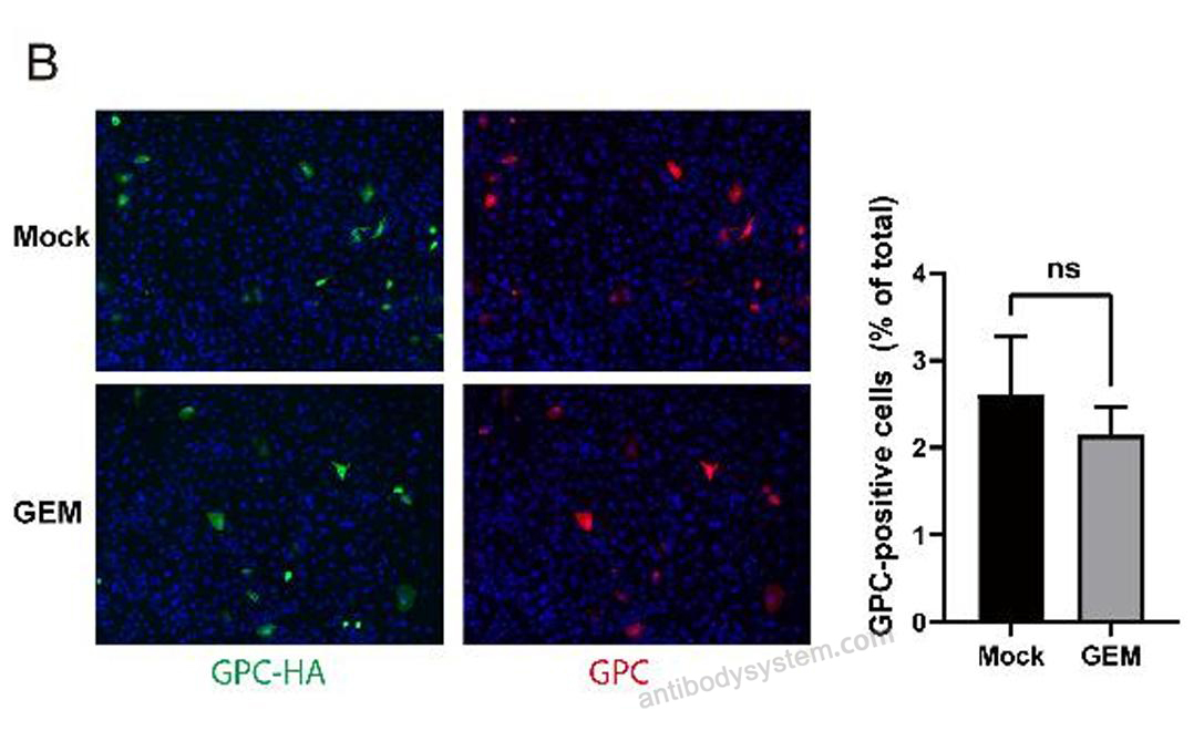 Immunofluorescence for Anti-LASV GPC Antibody (12.1F) ?>