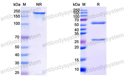 Anti-HCV NS1/gp68/gp70/Envelope glycoprotein E2 Antibody (HC33.4)