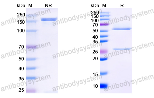 Anti-HCV NS1/gp68/gp70/Envelope glycoprotein E2 Antibody (HC33.8)